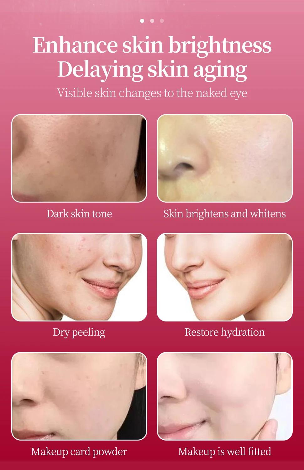 Contrôle de la cellule de tige saumon ADN sérum Peptide Jet soin Peeling Ampoule Spray eau oxygène c