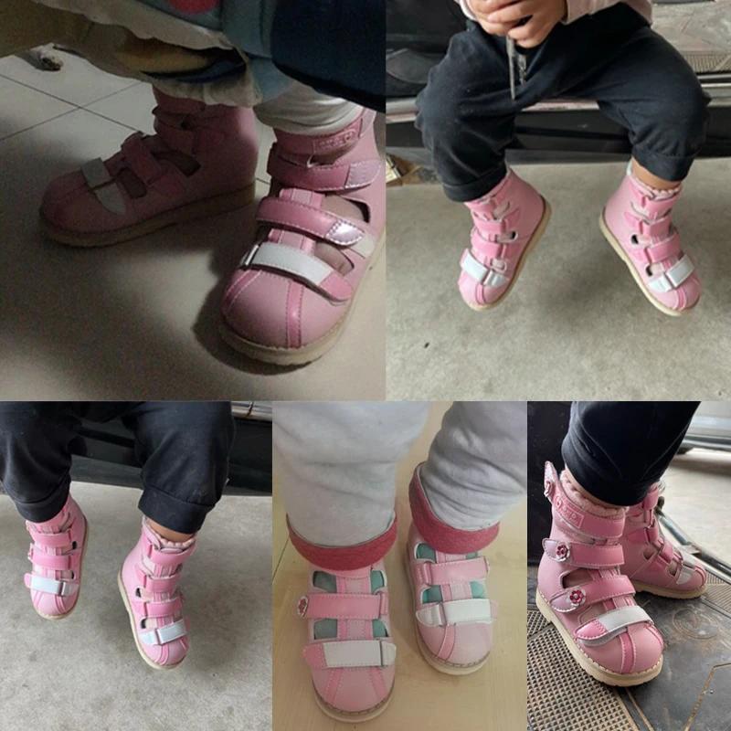 Ortoluckland – chaussures orthopédiques en cuir pour filles, sandales d'été pour enfants, chaussures