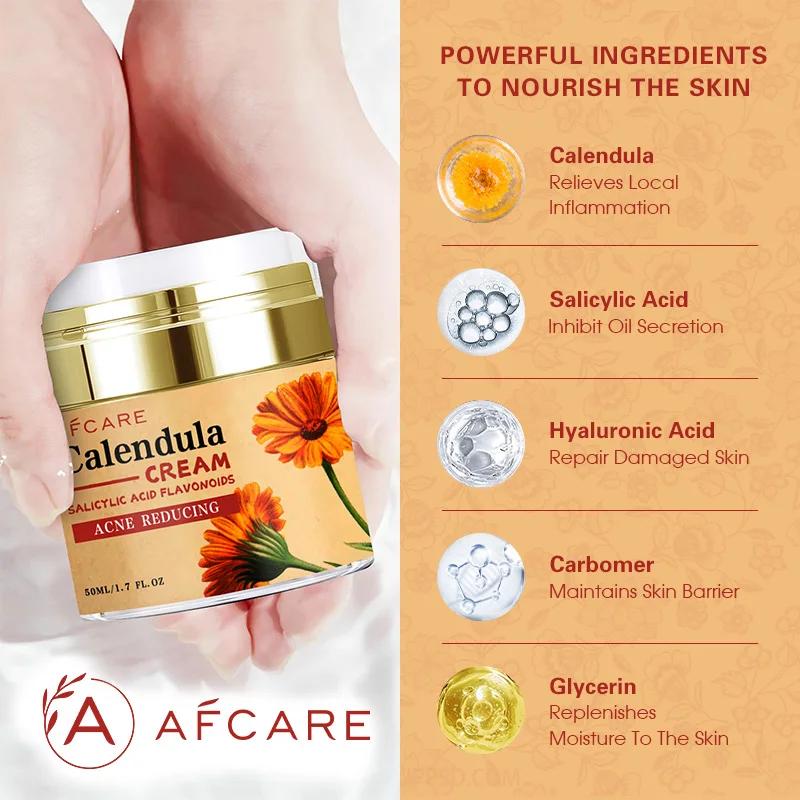 Crème hydratante puissante au calendule naturelle, 50ML, peau lisse, améliore la peau sèche et rugue