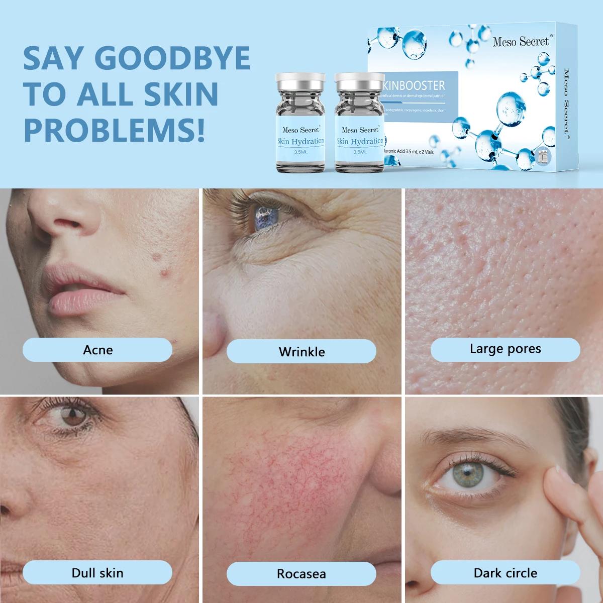 Sérum Ampoule Hydratant en Profondeur pour la Peau, Essence Éclaircissante et Hydratante, 2 Bouteill