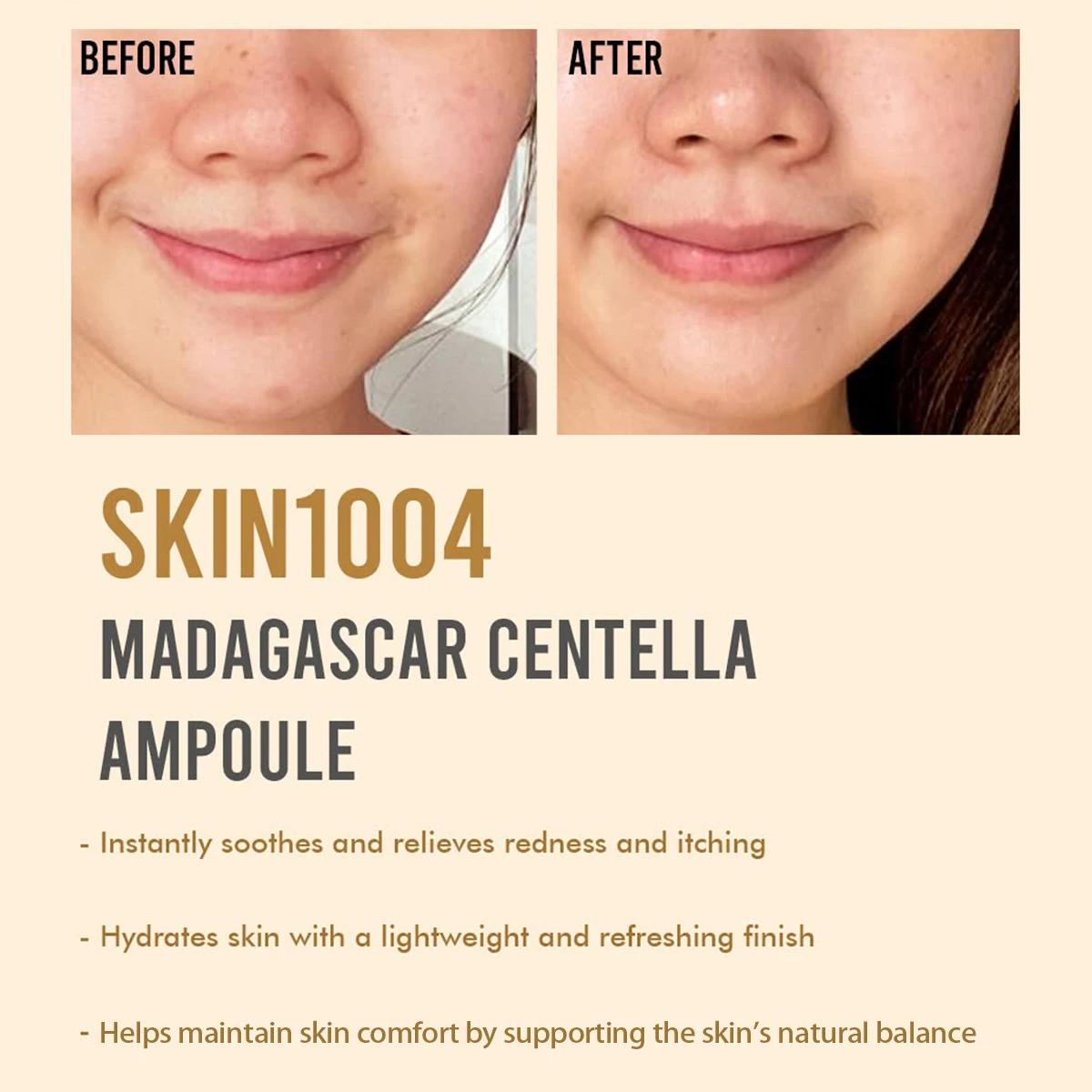 SKIN1004 Ampoule à la Centella de Madagascar 55ml, apaisante et régénérante, calme les rougeurs, lég