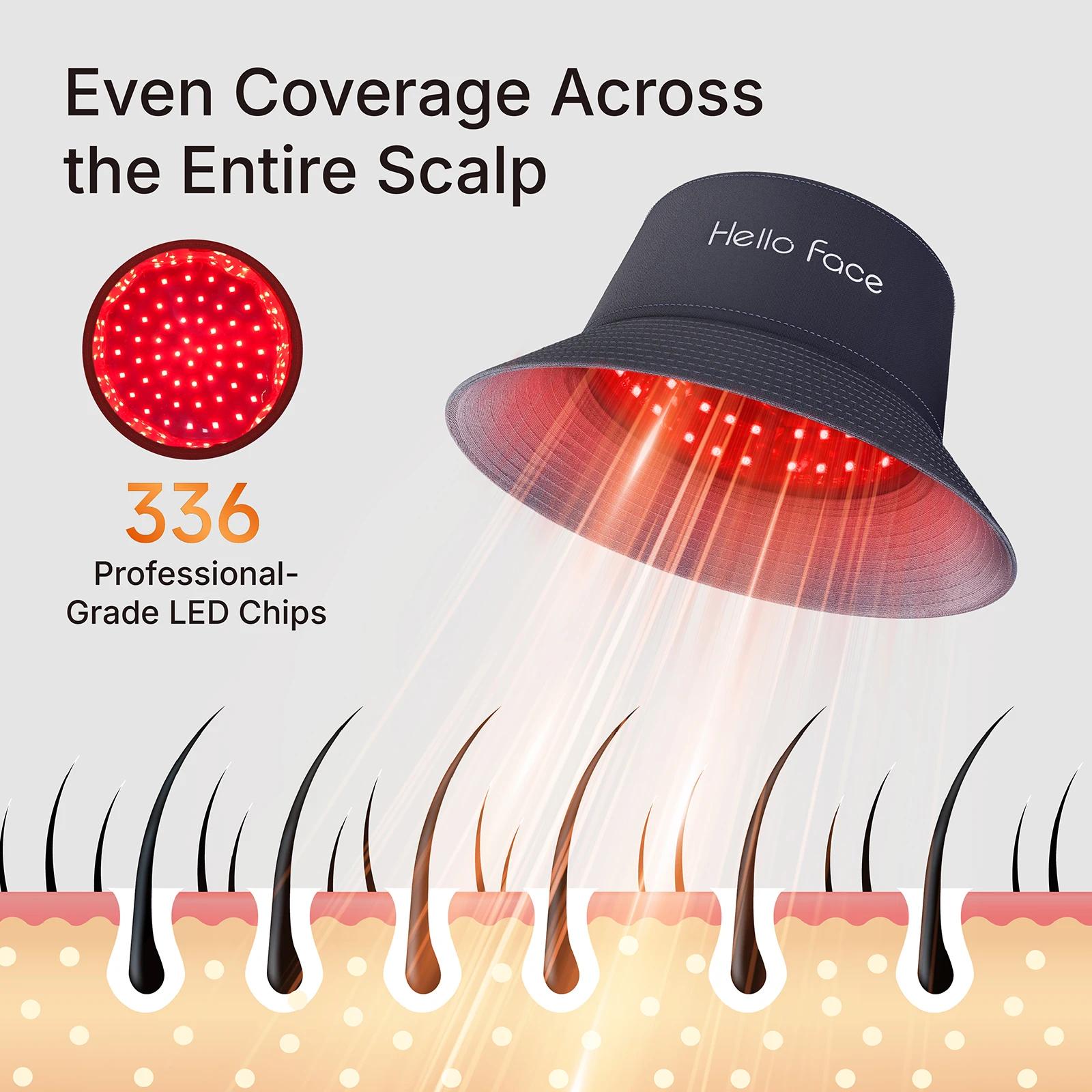 Chapeau seau pour thérapie à la lumière rouge, T100, 660nm et 850nm, 336 pièces, LED, Anti-perte de