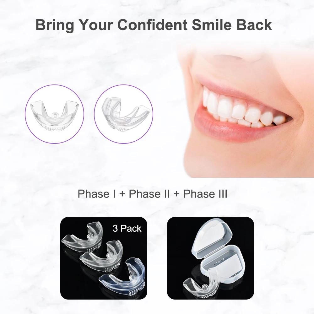 Appareil dentaire, accolades orthodontiques, entraîneur de dents, entraîneur d'alignement, embout po
