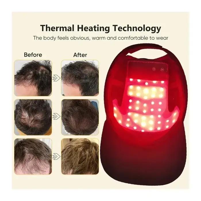Bonnet de thérapie à la lumière rouge LED, casque de croissance des cheveux, chapeau laser à Diode,